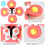 Kit com 3 Fidget Spinners com Ventosa para Crianças - Brinquedo Giratório 6