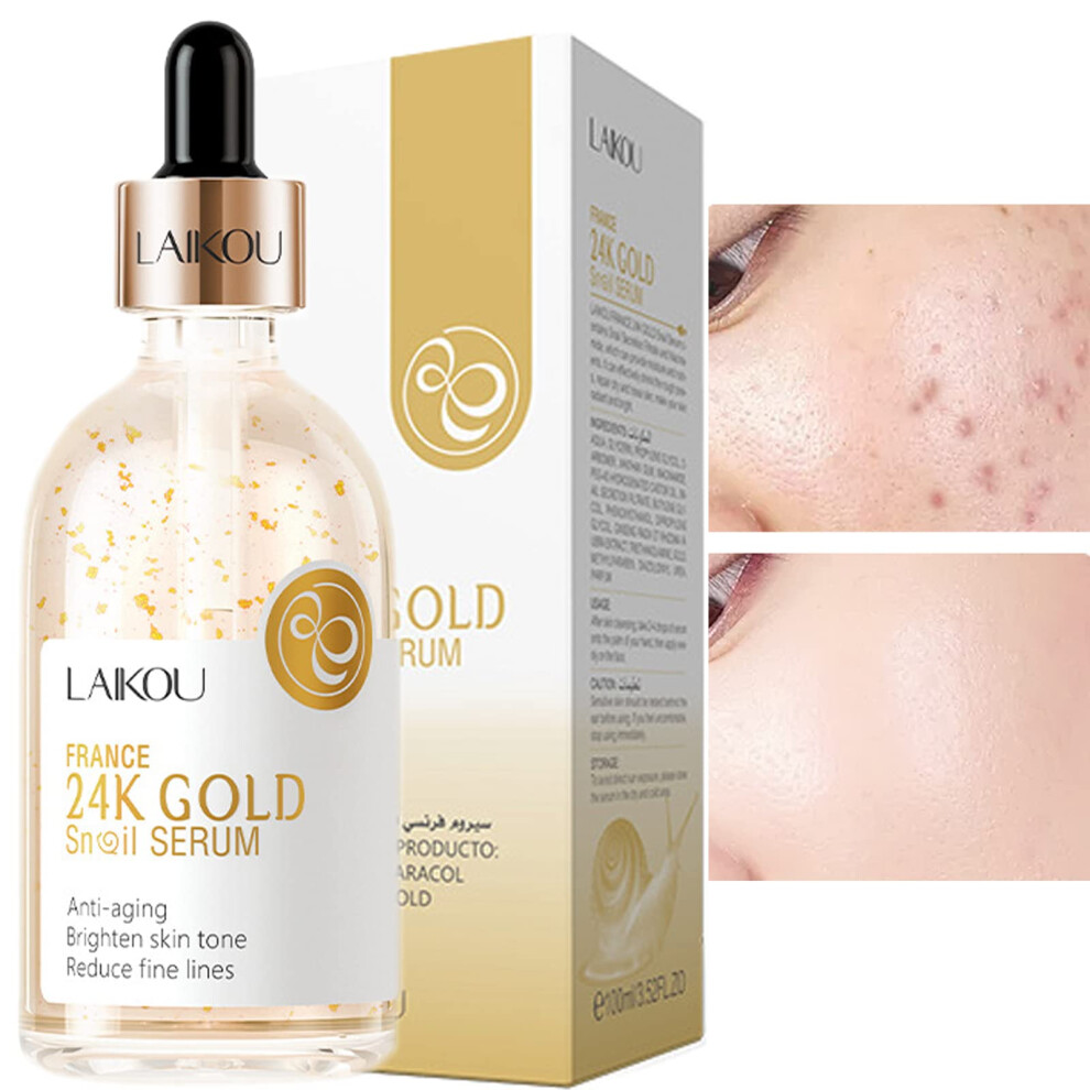 Gold 24K Snail Serum With Niacinamide And Hyaluronic Acid For Deep Hydration And Brightening