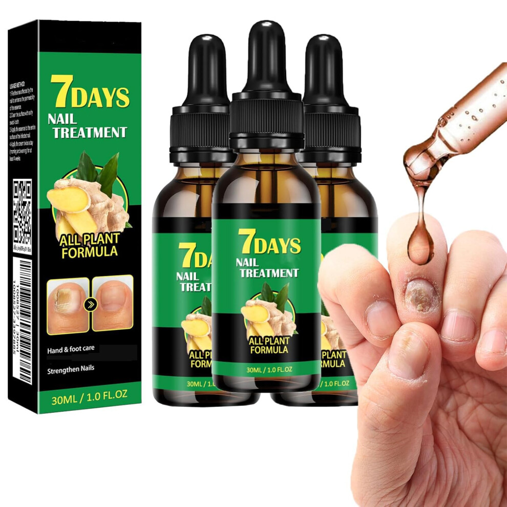 Ginger Cuticle Oil Nail Growth Serum for Strengthening and Hydrating Nails, 3pcs 1fl oz