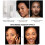 Concealer Stick Full Coverage Under Eye for Dark Circles Moisturizing 13 Warm Olive 5