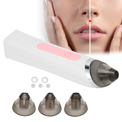 Εργαλείο καθαρισμού δέρματος Hydro Dermabrasion Aqua Peel, Καθαριστικό πόρων αρνητικής 1