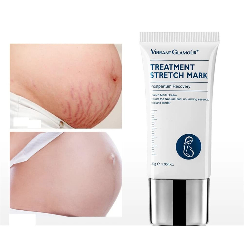 Cream Stretch Mark For Pregnancy And Postpartum, Natural Scar Removal, Skin Hydration, 1 Pcs