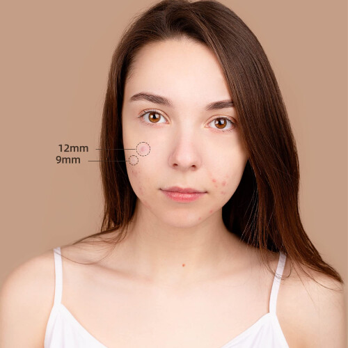 Acne Patch for Blemishes with Hydrocolloid Pimple Patch, Discreet Thin Design, Multiple Sizes 1