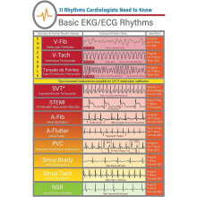Heart Disease Knowledge Posters Ecg Rhythm Recognition And Interpretation Metal Signs Room Decor Home Club Wall Decor Vintage Plaque 8x12 Inches