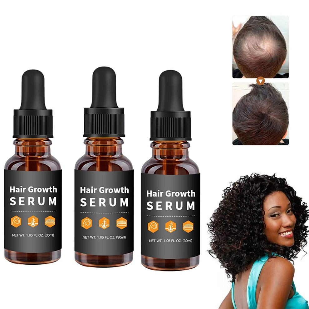 Hair Growth Serum for Women and Men, Hair Regrowth Treatment Boosts Thicker Fuller Hair, 3pcs