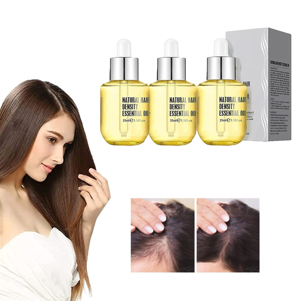 3pcs Ginger Biotin Hair Growth Serum for Thinning Hair, Fast Growth, Thicker Fuller Hair