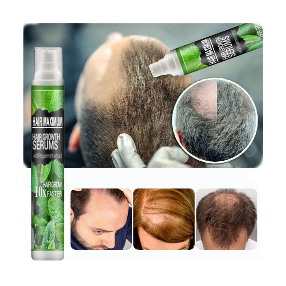 Ginger Hair Growth Serum Spray for Thinning Hair Loss, Deep Scalp Nourishment, 10ml