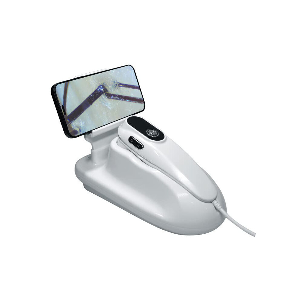 Wireless Scalp Detector And Hair Follicle Camera 50X 200X Dual Magnification With Led Lighting 9164114747952