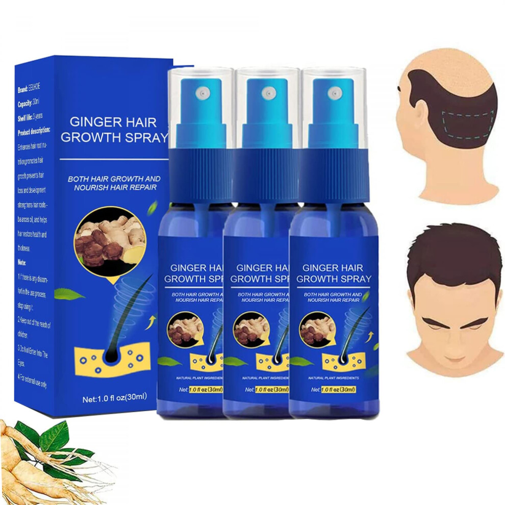 Hair Growth Spray with Ginger Essence for Men and Women, Anti Hair Loss Treatment, Fast Thicker Hair