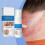(3pcs) Magnesium Herbal Psoriasis Spray, Magnesium Herbs Hauts 2