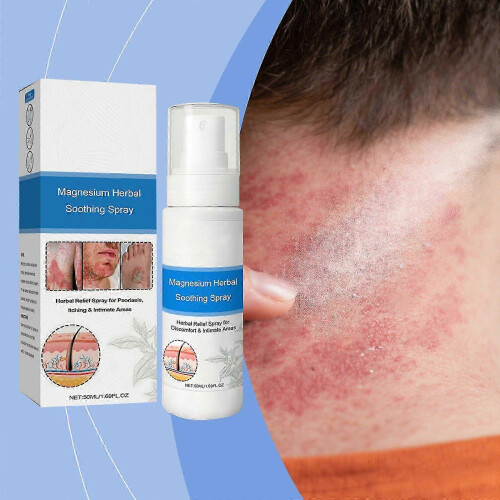 (3pcs) Magnesium Herbal Psoriasis Spray, Magnesium Herbs Hauts 1
