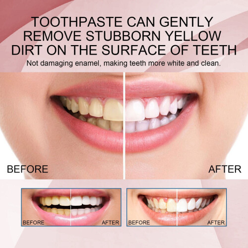 Bright Toothpaste Gloss Teeth ning Sp5Sp5Toothpaste Super Toothpaste Sp5Probiotic Toothpaste Deep Cleansing Care Toothpaste Fresh Breath120g! 1