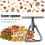 All Nuts Cracker, Stainless Steel Heavy Duty Nut Cracker for Your Cooking and Snacking Needs 3