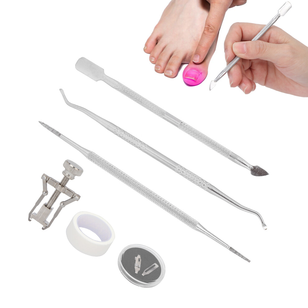 Stainless Steel Ingrown Toenail Corrector Kit with Nail Picker & Dual End File