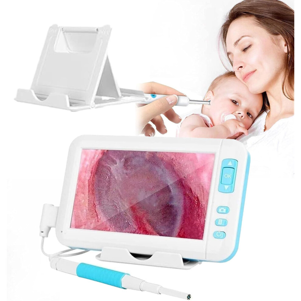 Ear Wax Removal Camera with 4.3 Inch Display, 1920P HD Otoscope Ear Cleaner, 3.9mm Lens