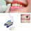 Temporary Denture Braces Occlude Upper Dentures Veneer Dentures Missing Teeth Broken Teeth Elq 4