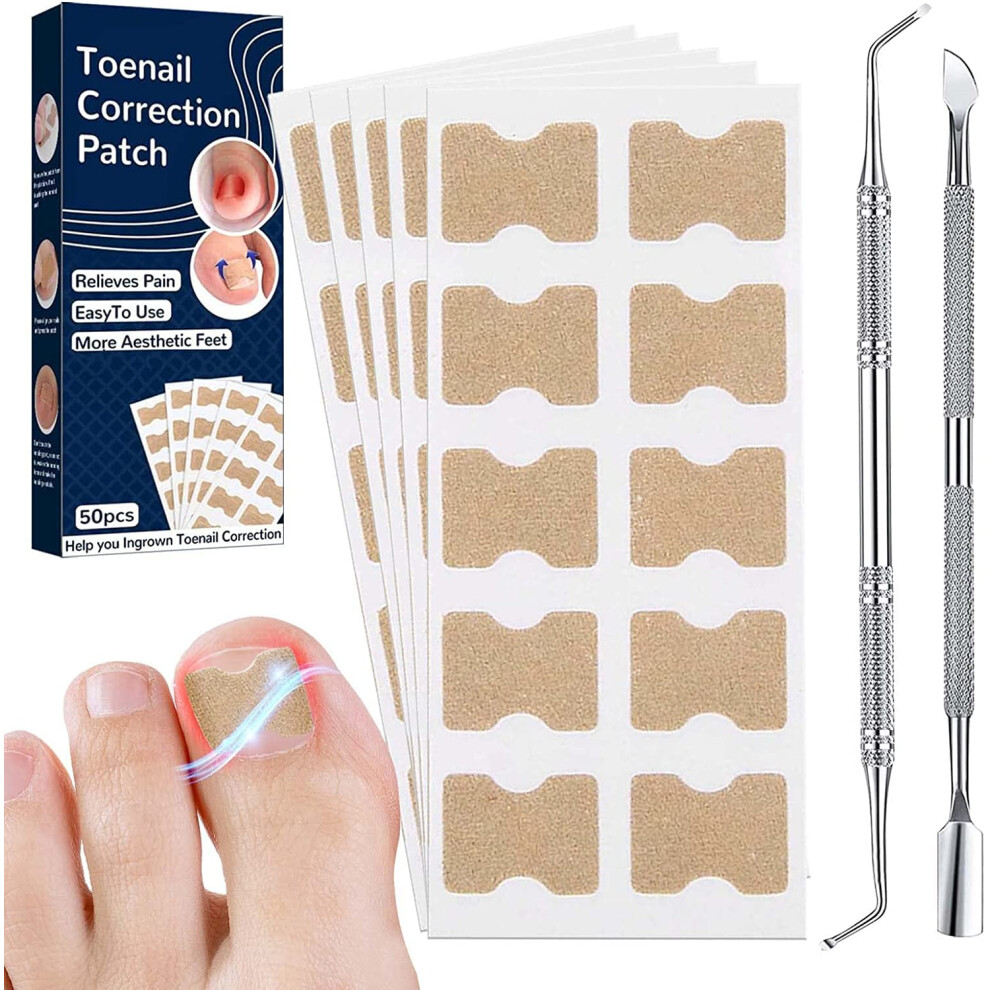 1 Pack Ingrown Toenail Corrector Strips 100pcs Painless Adhesive Nail Lifting Treatment Patches