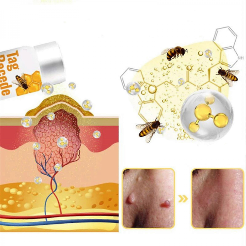 (2pcs) Tag Recede Bee Venom Treatment Spray 2024 2