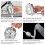 hard water filter Shower filter, soft hard water filter 2