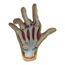 Handmodel voor artrose, model van handpathologie, replica van menselijke anatomie en fysiologie, anatomiemodel voor de dokterspraktijk