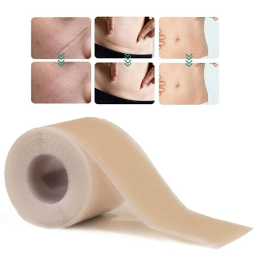 Silikonteip/plaster for arr - Behandle arr 2