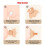 Breast Care 7
