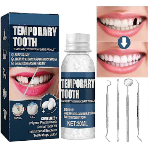 Tooth Repair Kit - Temporary tooth filling, replacement for missing or broken teeth