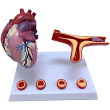 Anatomical Heart Model Life Size with Removable Bypass for Coronary Artery and Thrombosis Study