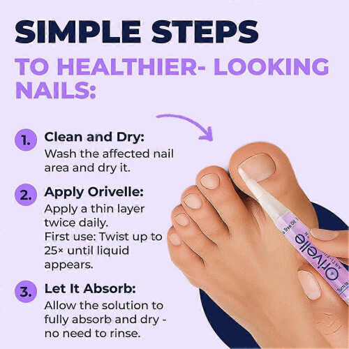 Antifungals Nail Repair Solution Extra Strength Pen για εύθραυστα κατεστραμμένα νύχια Θρεπ 1