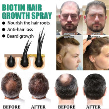 Biotin Thicken Hair Oil Gyors Növekedés Szérum Törésgátló Haj Törés Hajhullás Kezelése Spray Erősítő Haj Egészség Férfi Nők