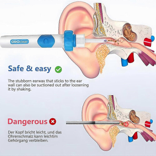 Νέο Oroclear Earwax Remover,Ηλεκτρικό καθαριστικό αυτιών,Αφαίρεση αναρρόφησης κεριού 2