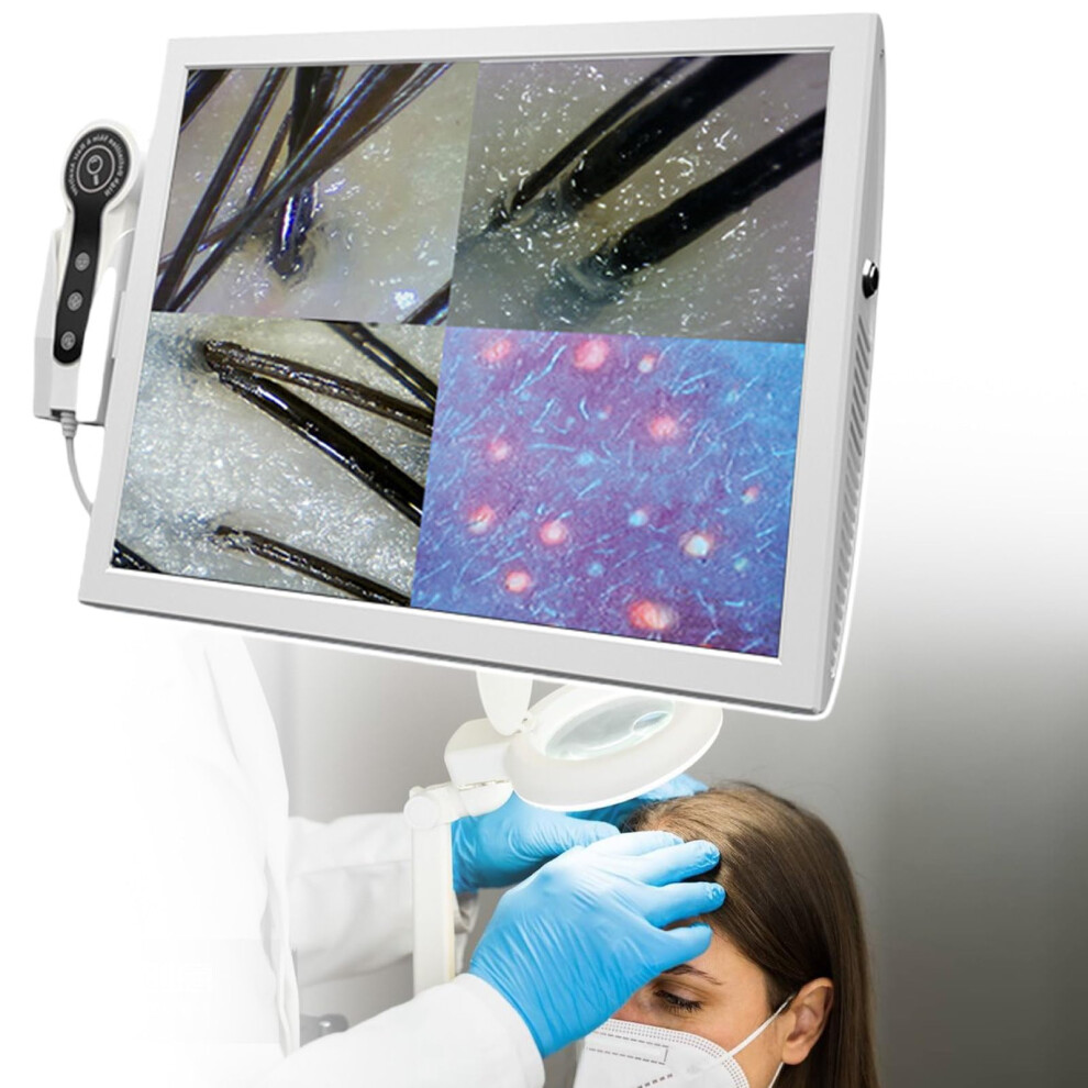 15 Inch Skin Analyzer and Scalp Hair Follicle Detector with Ultra HD Imaging and Dual Magnification