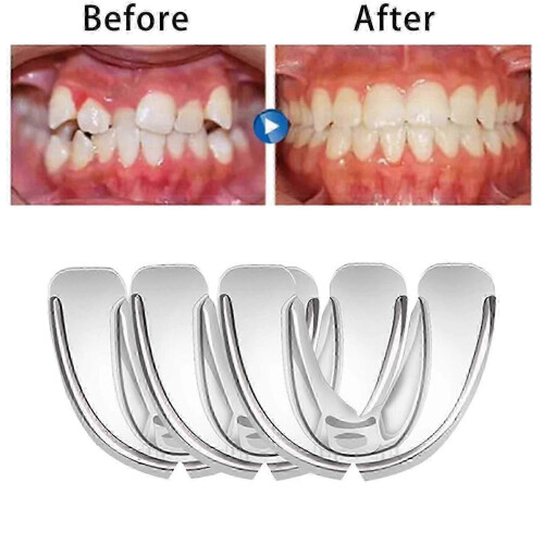 Teeth Retainer Tooth Aligners-3-σε-1 Δίσκοι για ίσιωμα και διόρθωση δοντιών 2