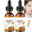 Frankincense Face Oil Organic Deep Hydration Smooth Complexion for Face and Body 2PCS 1