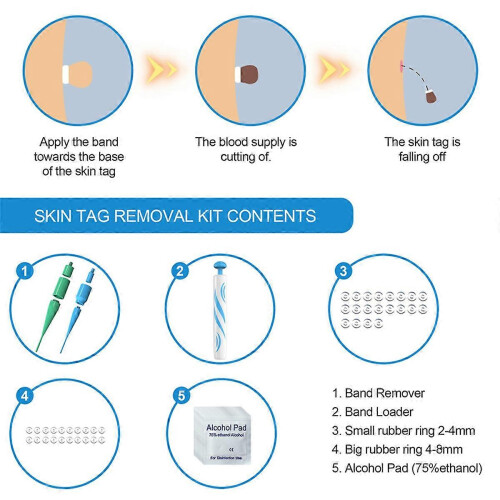 Skin Tag Mole Wart Remover Kit Removal Device with Band Rubber Rings 1