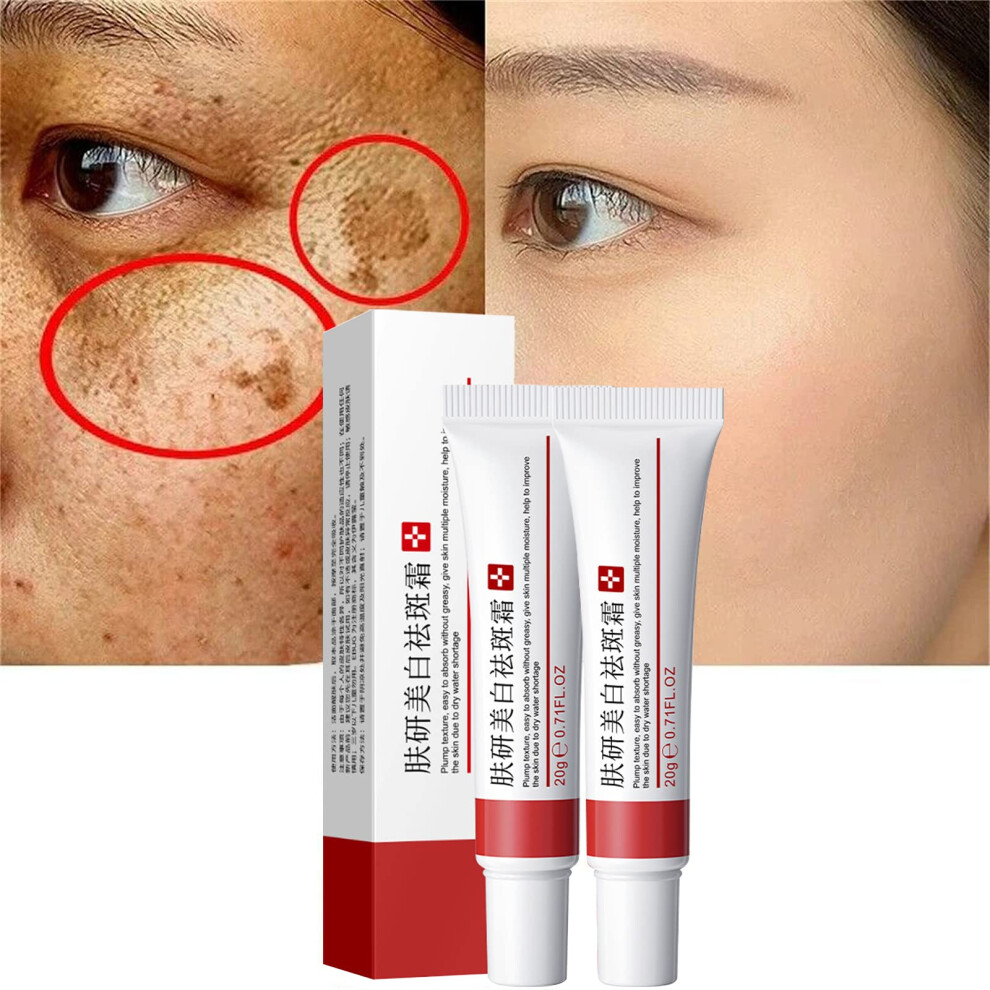 Cream/Dark Whitening Freckle Removal Duo Brightens Skin Tone Fades Spots Melasma Wrinkle Care