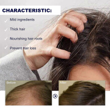 (1pcs)Hair Growth Serum Roll On, Promotes Thicker Fuller Hair For Women & Men, Natural Ingredients, All Hair Types