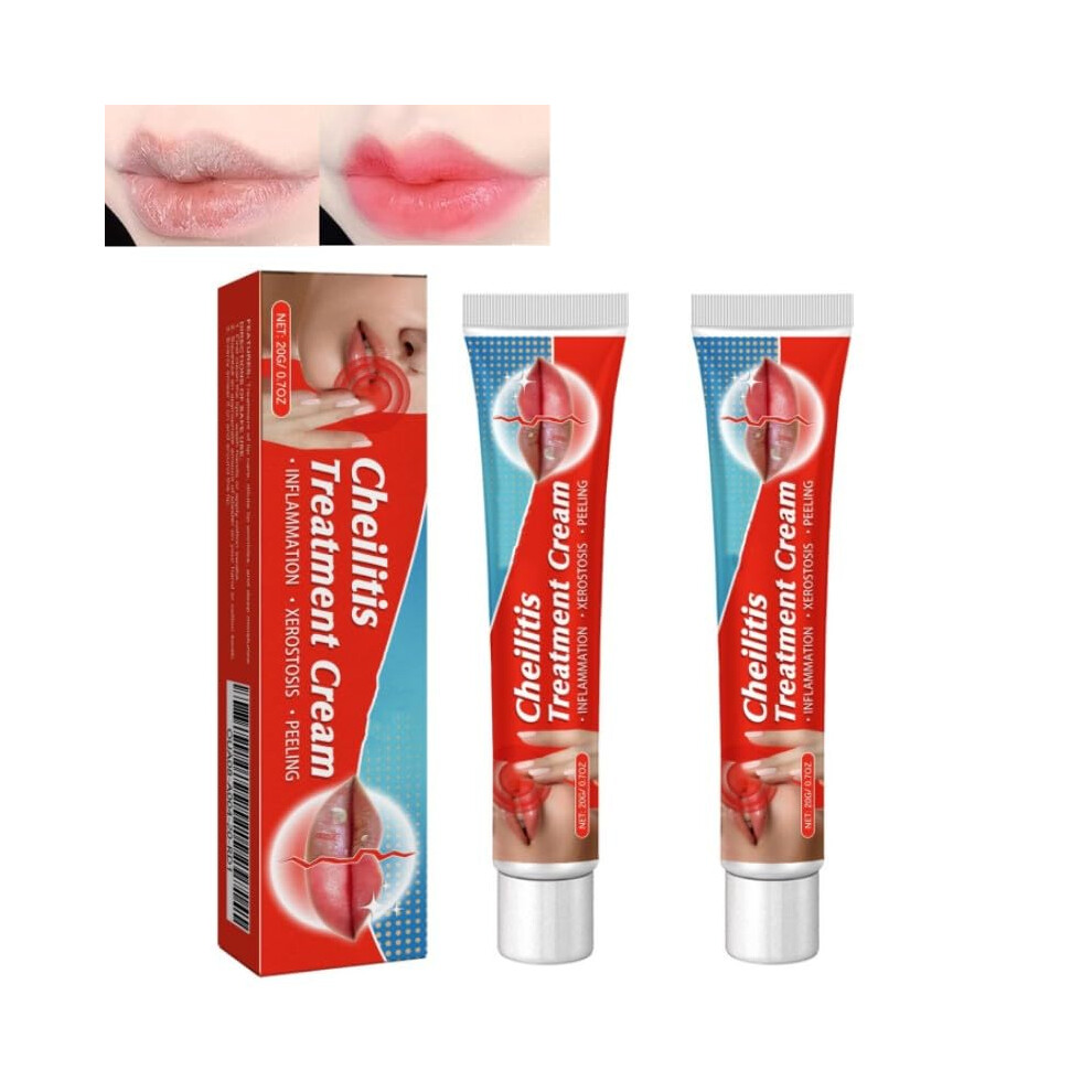Dark/Cream Lip Lightening Balm For Lips, Deep Moisture Lock Brightening 20G (2Pcs)