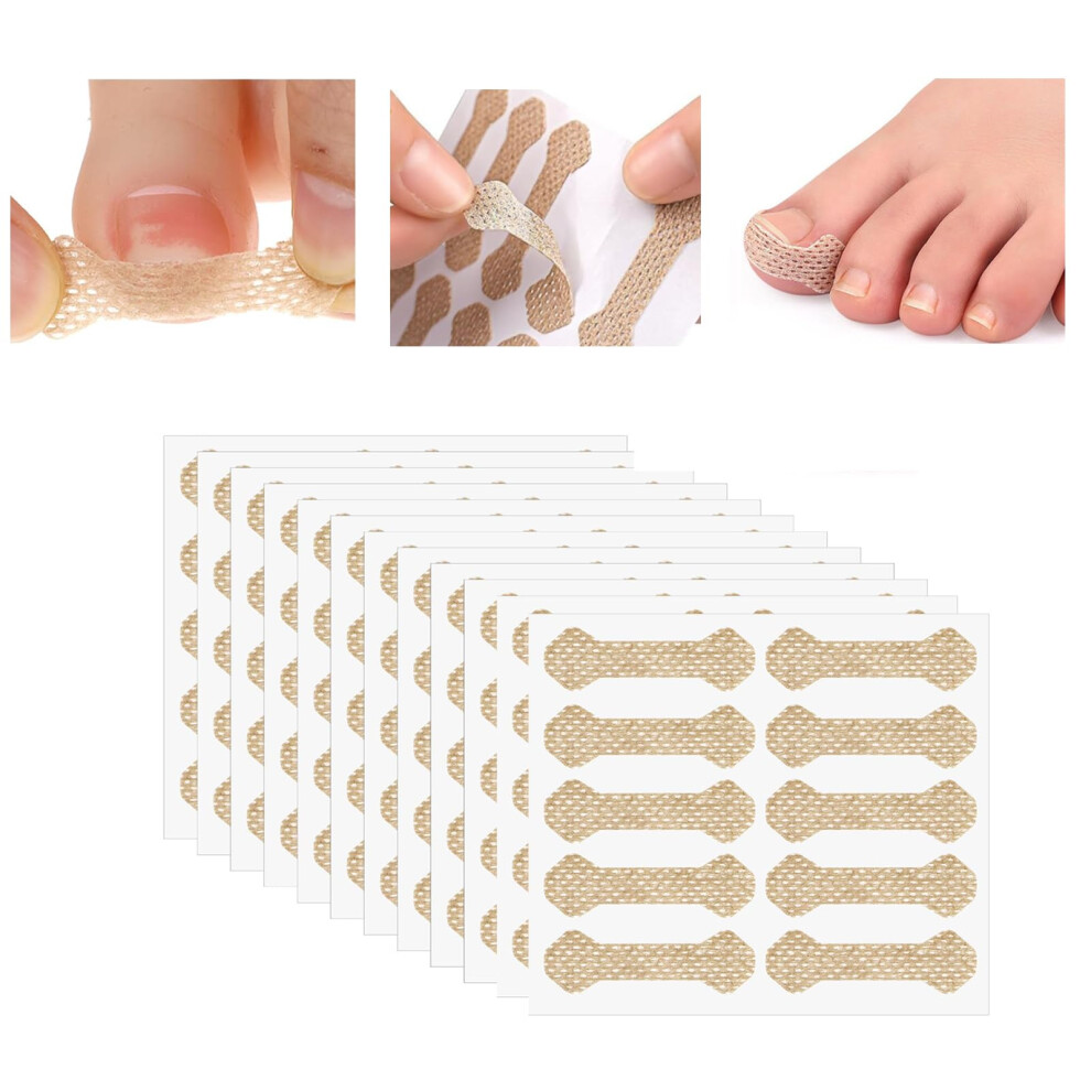 120PCS Ingrown Toenail Treatment Kit, Painless Breathable Corrector Strips with Secure Adhesive Hold