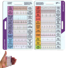 ECG/EKG Rhythm Pocket Card, Double Sided EKG Interpretation Badge Card with Calipers for Nurses, Techs, Students (2PCS)