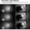 AK-R22 Collapsible Diffusion Dome, Diffuser for V1 Round Head Flash, AD100Pro, AD200Pro( 4