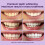 OnlySmile Zahnbleaching-Kit Dream Team Bundle – Zahnbleaching Set mit Zahnpulver 5