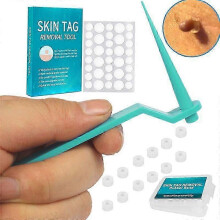 (20 pc,Green)20Pc Micro Band Non Toxic Face Care Mole Wart Tool For Small To Medium Blue Skin Tag