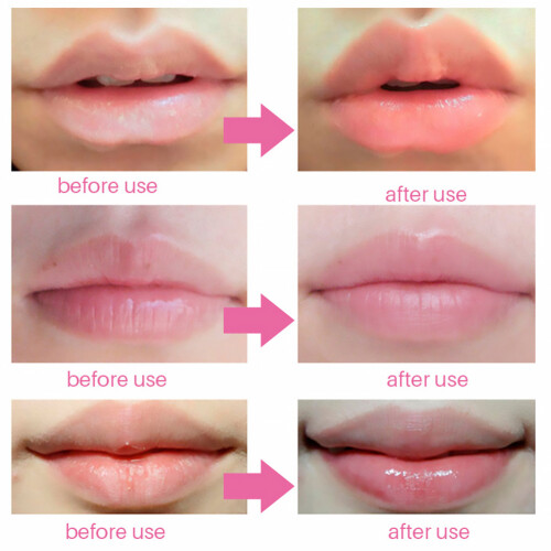 60Pièces Patchs Collagène Gel Hydratants Rose 2
