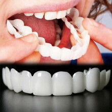 Teeth Whitening Device and Temporary Dental Alignment Tool with Adjustable Fit for Men and Women