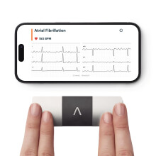 KardiaMobile 6-Lead Personal ECG Heart Rate Monitor - Detects Atrial Fibrillation, Trusted by the NHS, Results in 30 Seconds, Works with Most Smartph