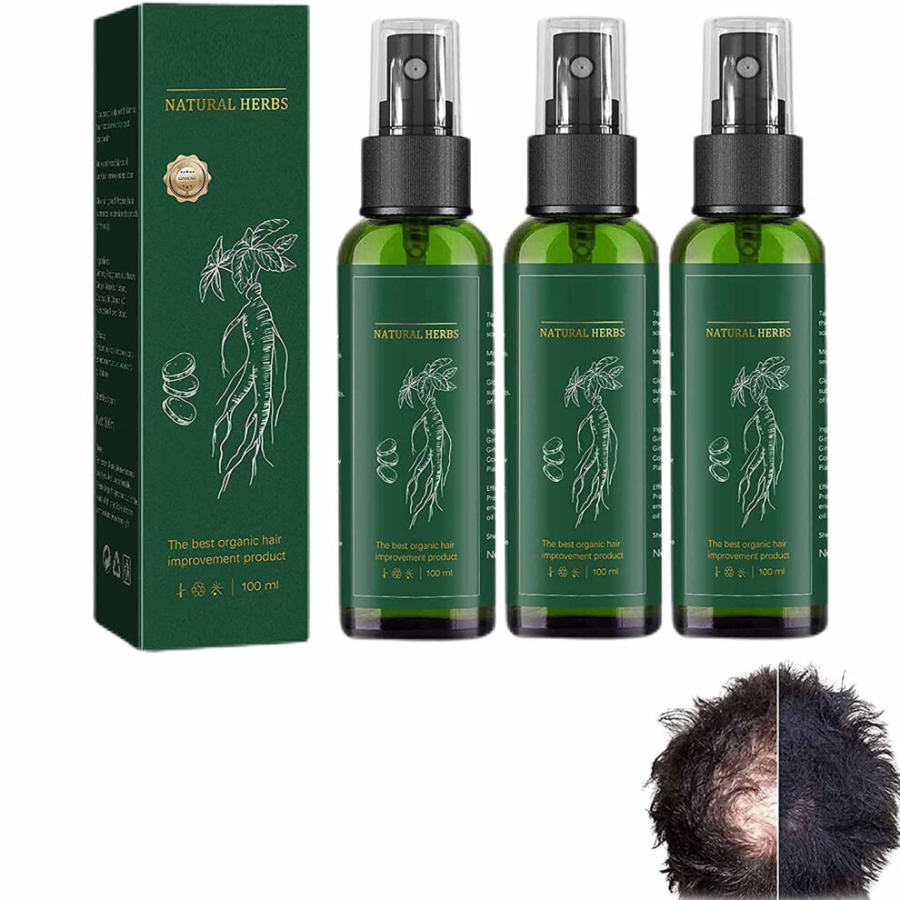 Red Ginseng Hair Growth Spray For Men And Women, Ginger Ginseng Hair Regrowth Serum 3Pcs Thicker Fuller Hair