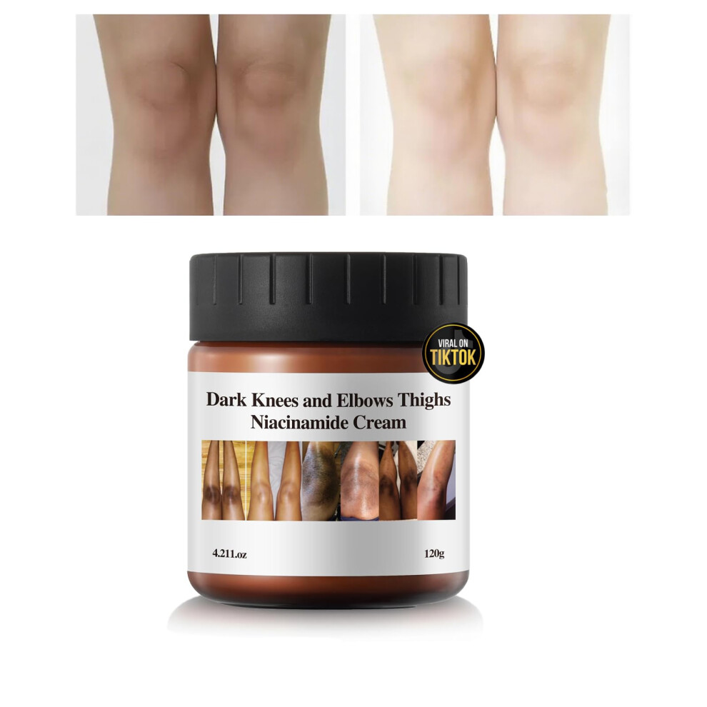 Cream/Dark Skin Brightening For Spot Removal, Underarm And Elbow Whitening, 4.21Fl Oz