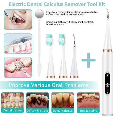 (basic model, white) Smart Sonic Electric Toothbrush Rechargeable 5-speed Ultrasound Teeth Whitening 1