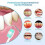 (basic model,black)Smart Sonic Electric Toothbrush Rechargeable 5-speed Ultrasound Teeth Whitening 5
